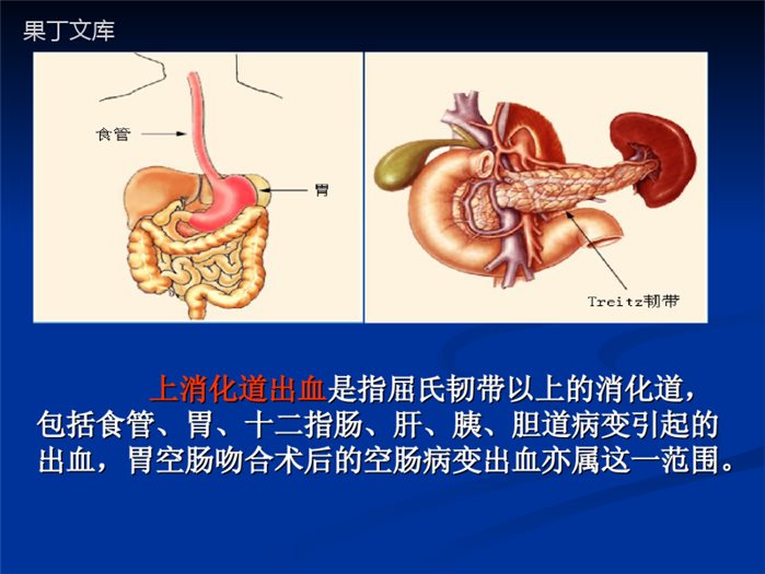 消化道出血护理查房(带病例)